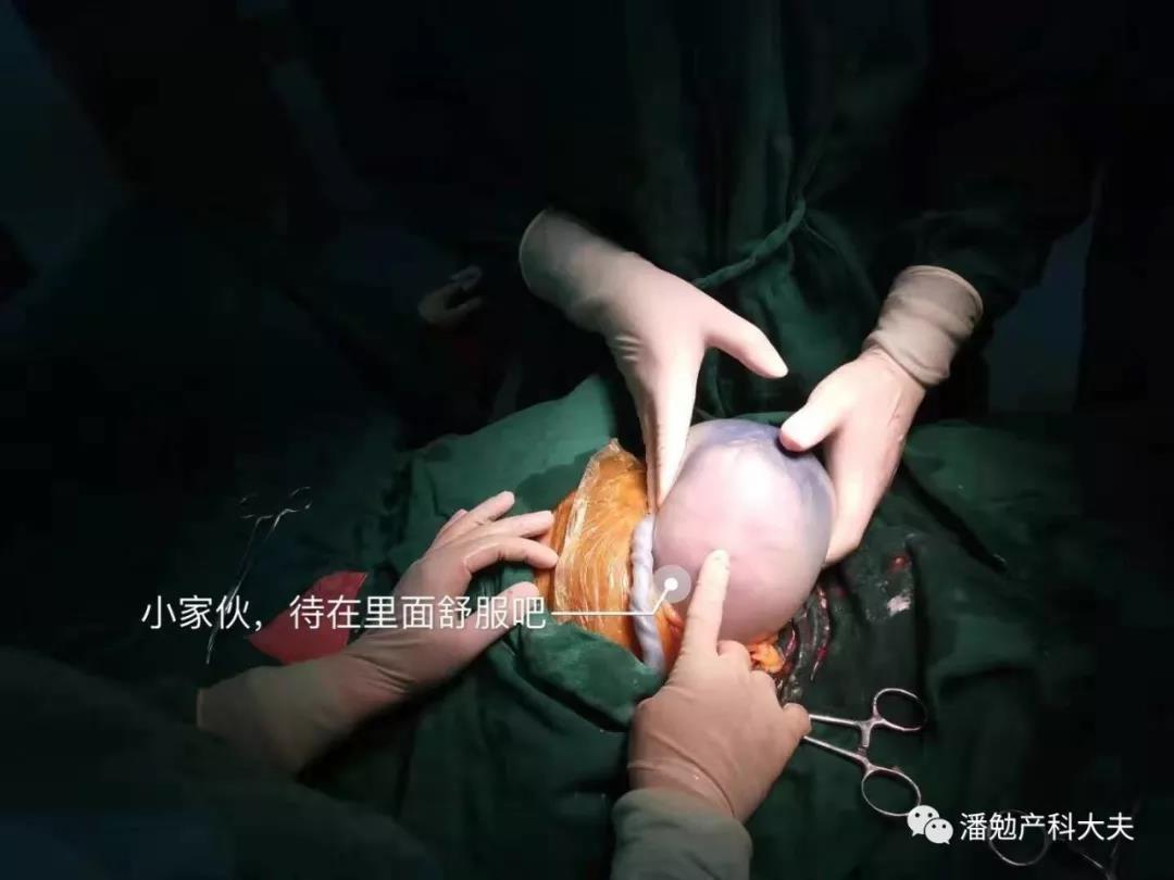 “哪吒”寶寶？福州一媽媽懷胎十月“生下”一個“球”