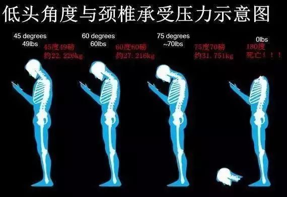 福州一男子下肢無力、行走不穩(wěn)……教你4招遠離頸椎病！