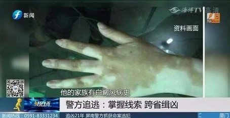 追兇21年！僅憑一張照片和一個體征　福建警方抓住逃犯