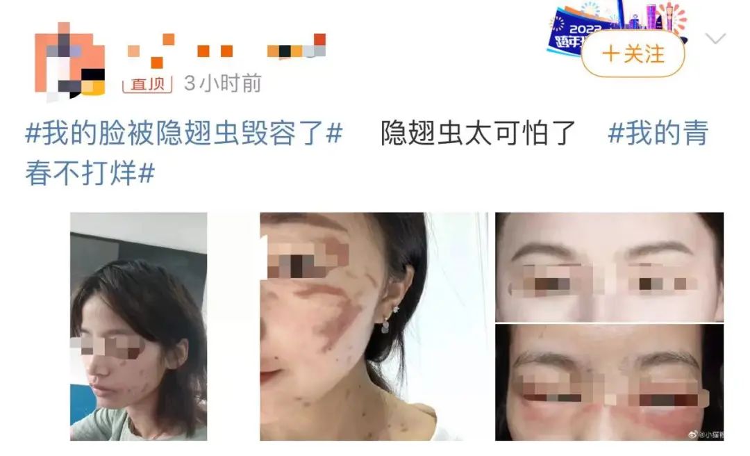 長樂人注意！千萬別拍！有人差點毀容、失明……