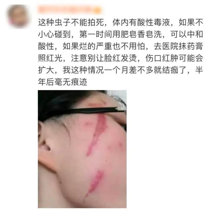 長樂人注意！千萬別拍！有人差點毀容、失明……