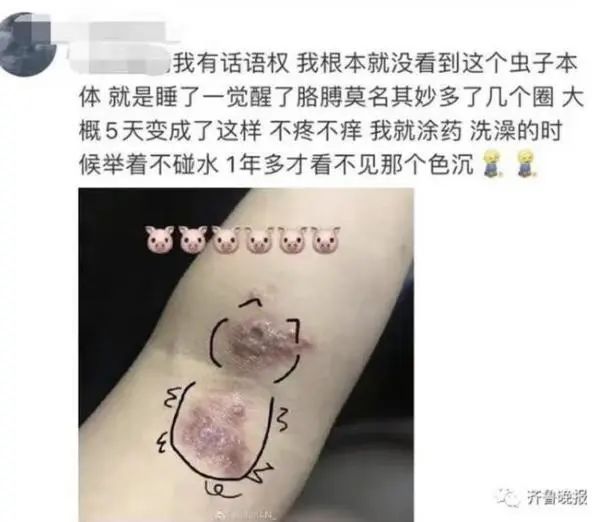 長樂人注意！千萬別拍！有人差點毀容、失明……